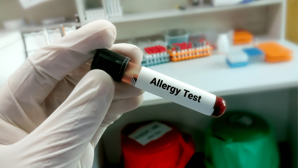 A Comprehensive Guide to Allergy Testing
