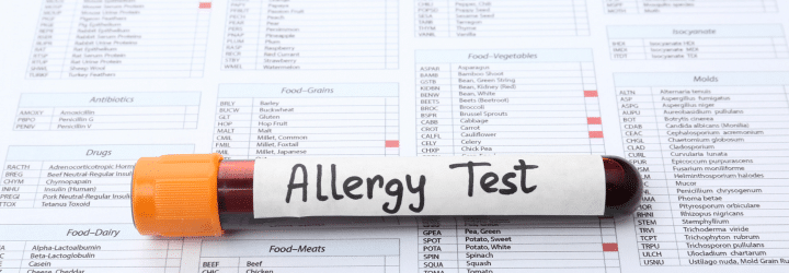 Allergy Testing - Accuracy of Skin vs Blood Test?
