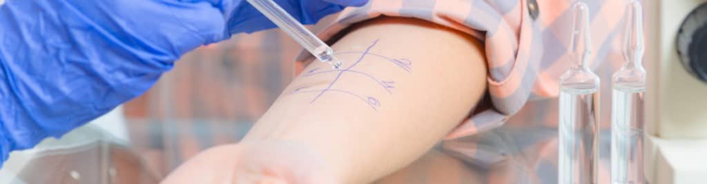 Allergy Test