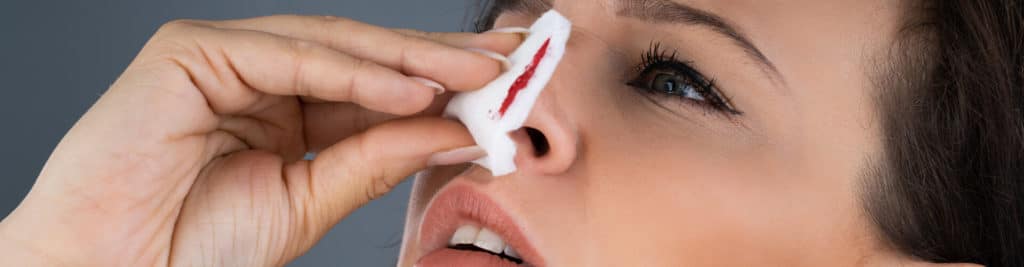 Nosebleeds